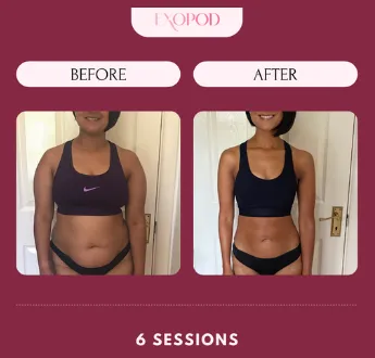 ExoPod before and after results - 6 sessions