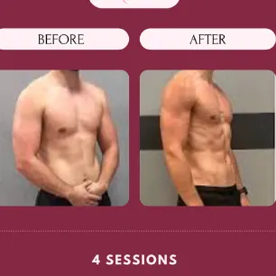ExoPod before and after results - 4 sessions