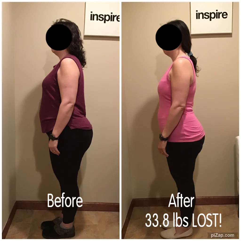 semaglutide westminster Weight Loss & Nutrition Westminster CO