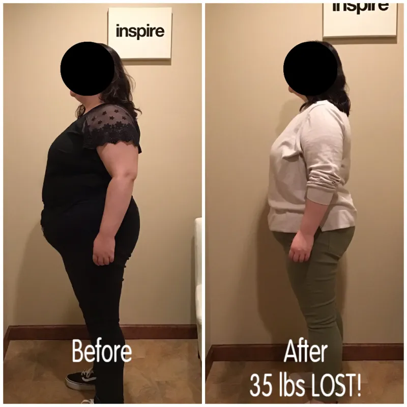 Go Figure Health client before and after — 35 lbs lost