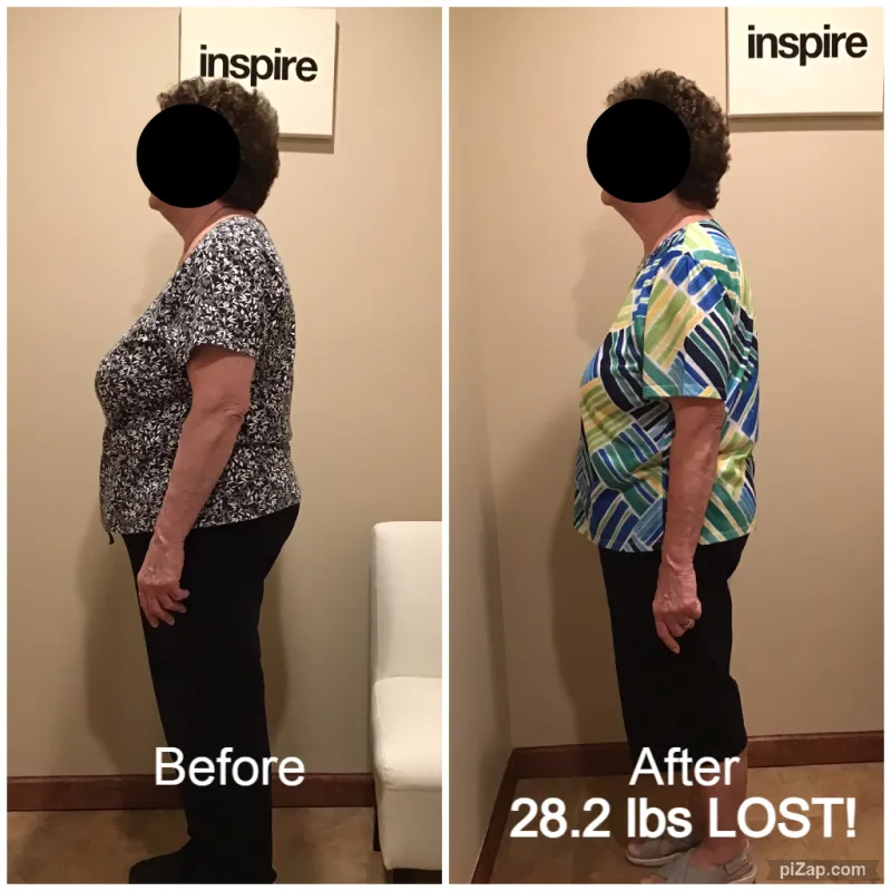 Go Figure Health client before and after — 28.2 lbs lost