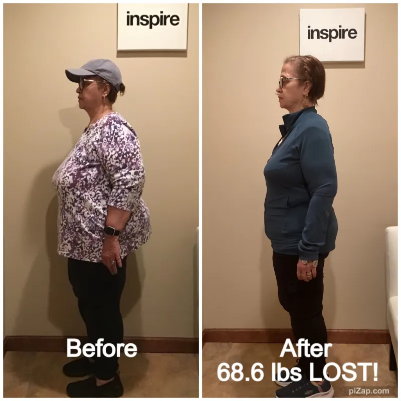 Go Figure Health client before and after — 68.6 lbs lost
