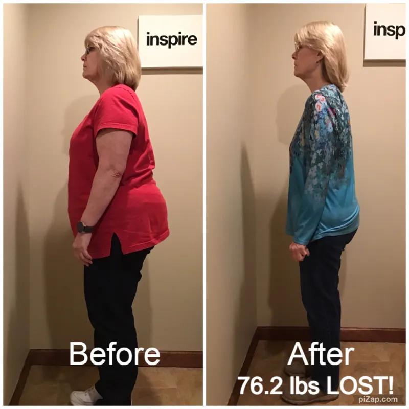 Go Figure Health client before and after — 76.2 lbs lost
