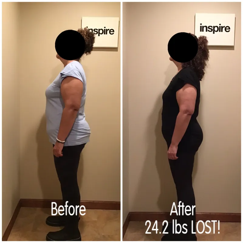 Go Figure Health client before and after — 24.2 lbs lost