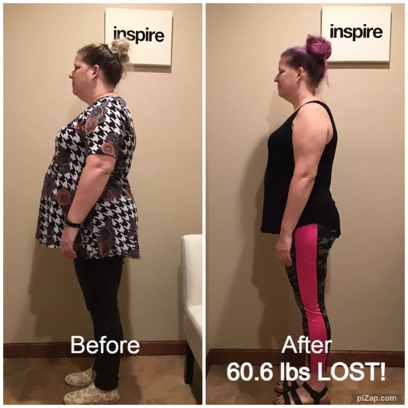 Go Figure Health client before and after — 60.6 lbs lost