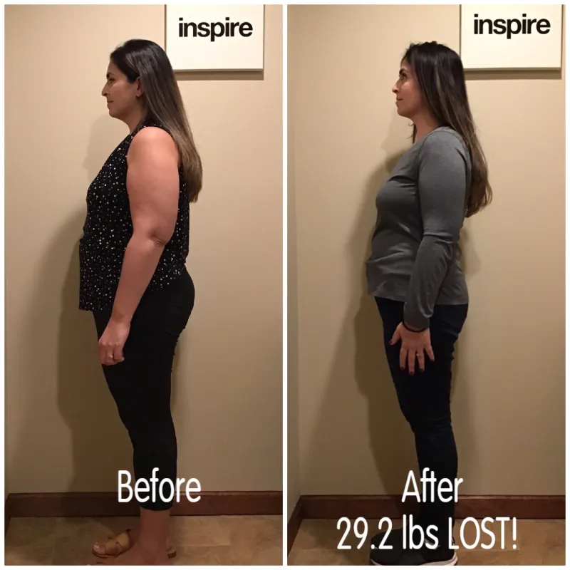 Go Figure Health client before and after — 29.2 lbs lost