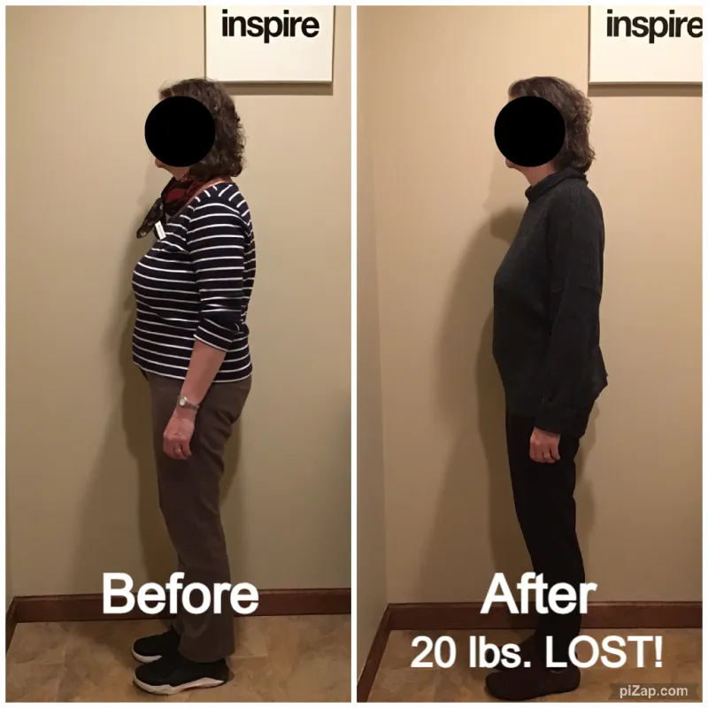 Go Figure Health client before and after — 20 lbs lost