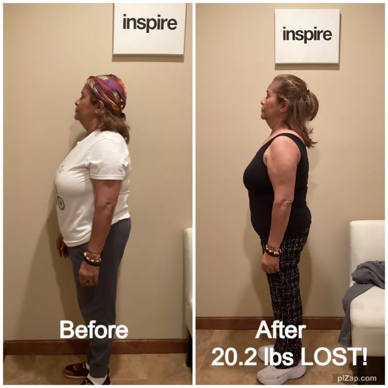 Go Figure Health client before and after — 20.2 lbs lost