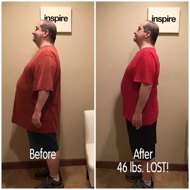 Go Figure Health client before and after — 46 lbs lost