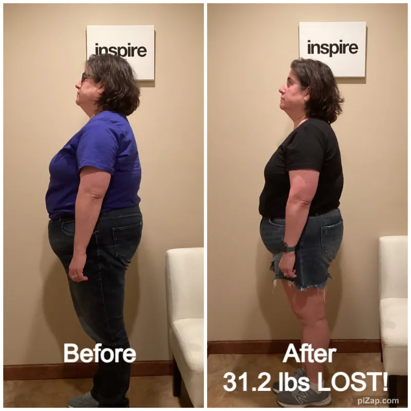 Go Figure Health client before and after — 31.2 lbs lost