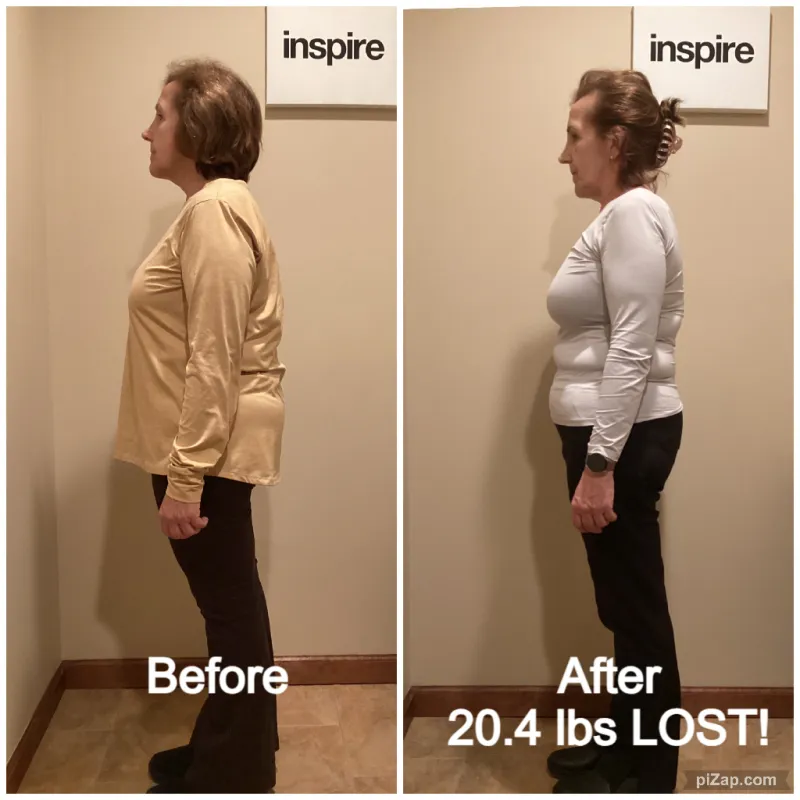 Go Figure Health client before and after — 20.4 lbs lost