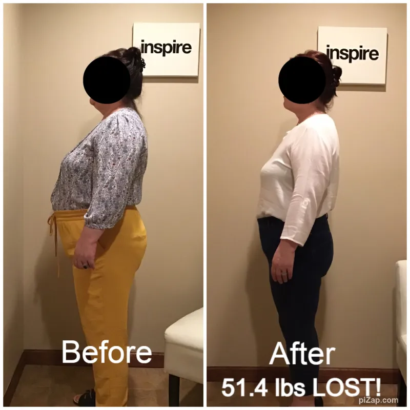 Go Figure Health client before and after — 51.4 lbs lost