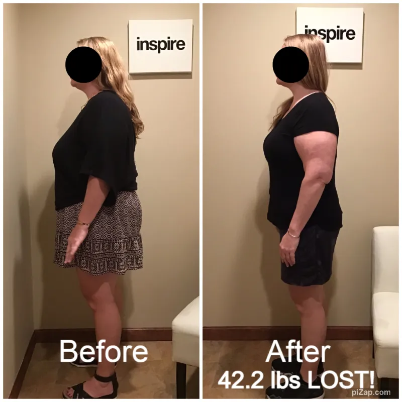 Go Figure Health client before and after — 42.2 lbs lost