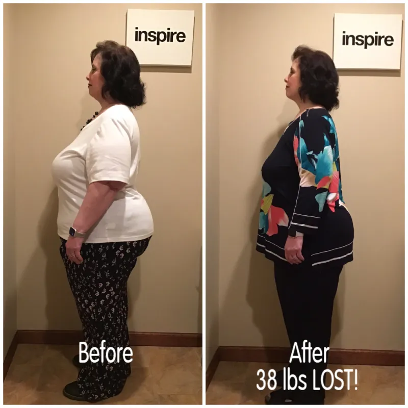 Go Figure Health client before and after — 38 lbs lost